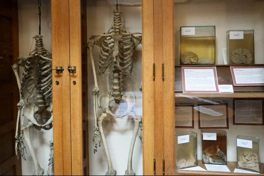 skeletons and brain slices on display in a medical history museum